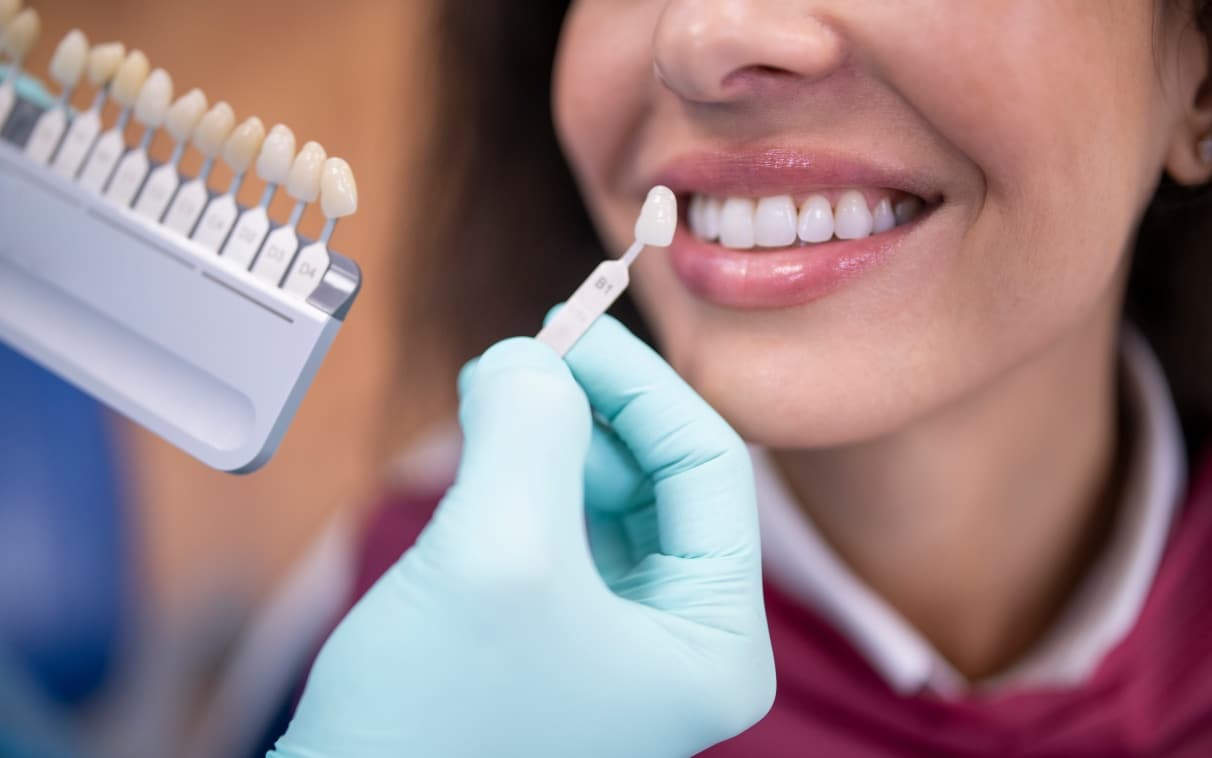 Résultat couronne dentaire - Cabinet Dr. Firdaous Moustaine Patient satisfait avec couronne dentaire - Dr. Firdaous Moustaine Casablanca